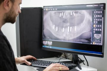 Digitalización extraoral en silla: Informes clínicos sobre un nuevo protocolo digital para el tratamiento quirúrgico y protésico de pacientes completamente edéntulos Digitalización extraoral en silla: Informes clínicos sobre un nuevo protocolo digital para el tratamiento quirúrgico y protésico de pacientes completamente edéntulos