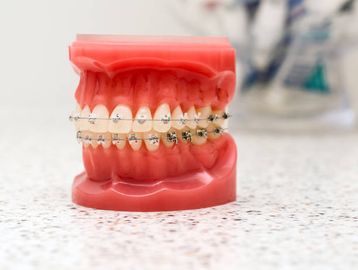 Cirugía de la maloclusión clase III: ¿cuándo hacer sólo cirugía mandibular? Cirugía de la maloclusión clase III: ¿cuándo hacer sólo cirugía mandibular?