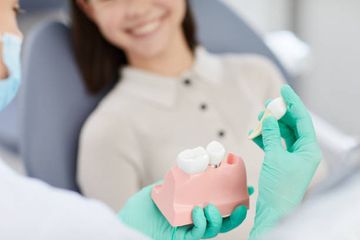 Fattori di successo nel trapianto autologo dei denti