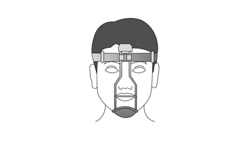 Orthopedic Traction Devices in Orthodontics: Extraoral Appliances. Headgear, Facial Masks, Chin Cups