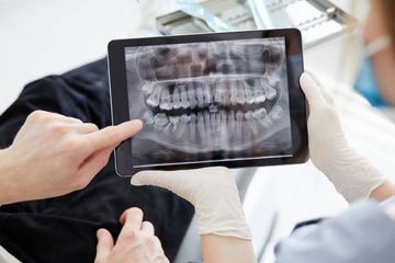 Mentoplasty: isolated aesthetic chin surgery or in combination with orthognathic surgery Mentoplasty: isolated aesthetic chin surgery or in combination with orthognathic surgery
