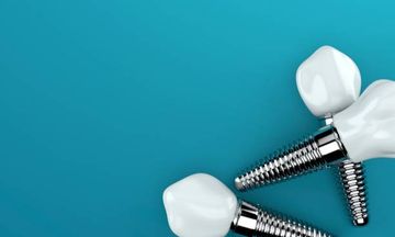 Clinical and radiological outcomes of 1- versus 2-stage implant placement: 1-year results of a randomised clinical trial Clinical and radiological outcomes of 1- versus 2-stage implant placement: 1-year results of a randomised clinical trial