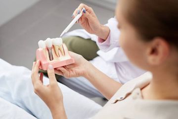 Polyetheretherketon in der Implantatprothetik: Eine Überblicksübersicht Polyetheretherketon in der Implantatprothetik: Eine Überblicksübersicht