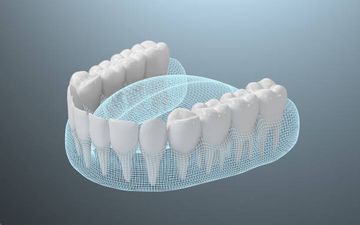 3D-картирование орошаемых участков пространства корневого канала с использованием микро-компьютерной томографии