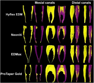 Multimethod Analysis of Three Rotary Instruments Produced by Electric Discharge Machining Technology