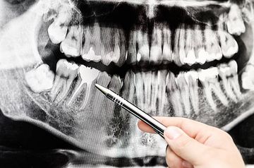 Criação de grupos experimentais bem equilibrados para estudos laboratoriais comparativos em endodontia: uma nova proposta baseada em micro-CT e métodos in silico