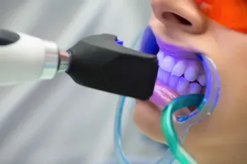 Лазерне випромінювання в стоматології