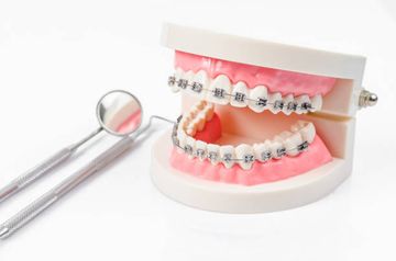Ortodoncia y cirugía ortognática del paciente con clase II dolicofacial: cambio de plano oclusal Ortodoncia y cirugía ortognática del paciente con clase II dolicofacial: cambio de plano oclusal