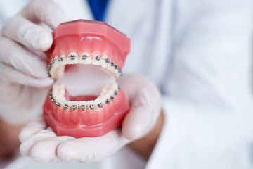 Kompensatorische kieferorthopädische Behandlung der dentalen und skeletalen Klasse III Malokklusion mit mandibulärer Asymmetrie