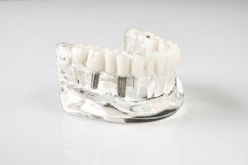 Tecnica di aumento dell'osso orizzontale con strato aumentato sub-periostale peri-impianto durante l'inserimento dell'impianto Tecnica di aumento dell'osso orizzontale con strato aumentato sub-periostale peri-impianto durante l'inserimento dell'impianto