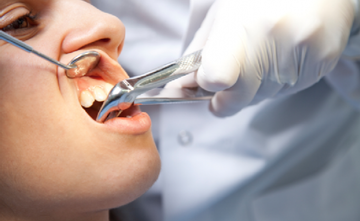 Complications during tooth extraction surgery