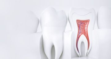 Errors in endodontic treatment during the tooth cavity opening stage