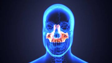 Eficacia de la terapia a largo plazo con macrólidos en dosis bajas para prevenir la recurrencia temprana de pólipos nasales tras la cirugía endoscópica de senos paranasales. Eficacia de la terapia a largo plazo con macrólidos en dosis bajas para prevenir la recurrencia temprana de pólipos nasales tras la cirugía endoscópica de senos paranasales.