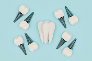 Cambio de plataforma frente a implantes de plataforma regular: resultados a 5 años post-carga de un ensayo controlado aleatorio