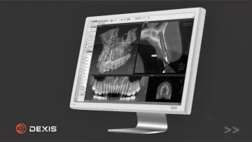 Рентгенологическое оборудование DEXIS для стоматологий. Знакомимся поближе