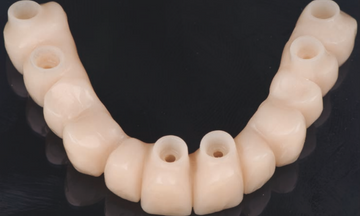 Flusso digitale nella riabilitazione orale Flusso digitale nella riabilitazione orale