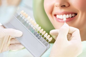 Sbiancamento dei denti. Tecniche, indicazioni e cura