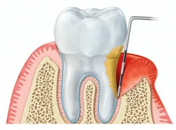 Строение тканей пародонта