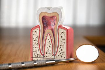 Root dentinal microcracks: a post-extraction experimental phenomenon?