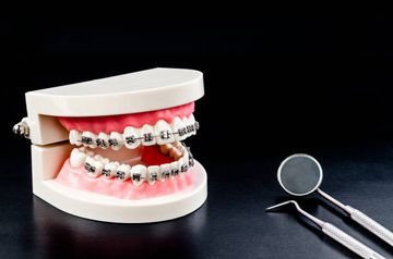 Trattamento multidisciplinare di un dente ancorato nella zona anteriore Trattamento multidisciplinare di un dente ancorato nella zona anteriore
