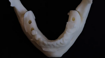 Prosthetic Surgical Templates and Dental Implant Site Time Preparation: An In Vitro Study