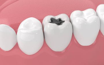 A comparative study of physicochemical properties of AH PlusTM and EpiphanyTM root canal sealants