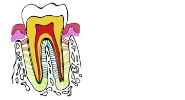 Effects of L-PRF and A-PRF+ on periodontal fibroblasts in in vitro wound healing experiments