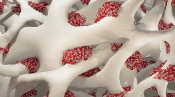 In Vitro оценка эффективности остеогенной дифференцировки клеток в присутствии пластин для костной пластики челюстей из полилактида (PLA) с различным составом