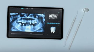 To Splint Or Not To Splint Short Dental Implants Under The Same Partial Fixed Prosthesis? One-Year Post-Loading Data From A Multicentre Randomised Controlled Trial To Splint Or Not To Splint Short Dental Implants Under The Same Partial Fixed Prosthesis? One-Year Post-Loading Data From A Multicentre Randomised Controlled Trial