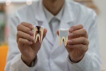 Comparação da Eficácia de Limpeza do Arquivo Autoajustável e Sistemas Rotatórios no Terço Apical de Canais em Forma Oval