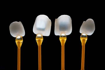 Adhesion and optics: The challenges of esthetic oral rehabilitation on varied substrates - Reflections based on a clinical report