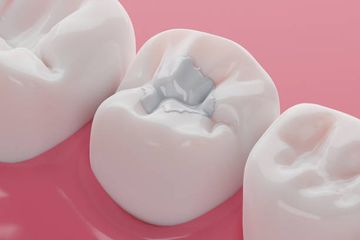 Mesiobuccal and Palatal Interorifice Distance May Predict the Presence of the Second Mesiobuccal Canal in Maxillary Second Molars with Fused Roots