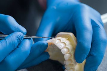 Class II Direct Restorations: Contact Point. Its Role and Restoration Techniques Overview