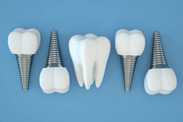 Tratamiento no quirúrgico de un defecto periimplantario inflamado Tratamiento no quirúrgico de un defecto periimplantario inflamado