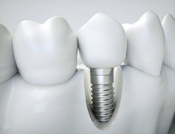 Cambiamenti volumetrici nei seni aumentati con un approccio crestal