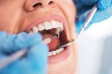 Un caso raro de quiste odontogénico ortoqueratinizado en la mandíbula anterior: manejo quirúrgico con osteosíntesis rígida preventiva.