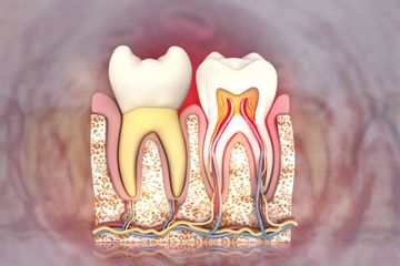 Micro-CT Evaluation of Root and Canal Morphology of Mandibular First Premolars with Radicular Grooves