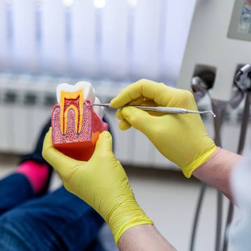 Micro-CT con contrasto per valutare il debridement del tessuto pulpare nei canali radicolari di denti estratti: una serie di esperimenti a cascata verso la validazione del metodo