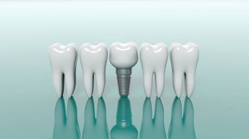 Clinical Treatment Concepts for Severe Periodontal Diseases