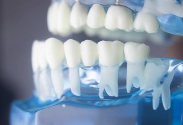 Second mesiobuccal root canal in maxillary molars—A systematic review and meta-analysis of prevalence studies using cone beam computed tomography