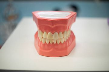 Anatomisch-topografische Variabilität der Wurzelkanaleingänge der Molaren im Oberkiefer