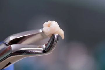 Técnicas de extracción de dientes.