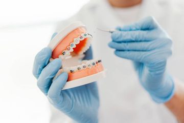 Процес роботи з термопластичними вирівнювачами в офісі