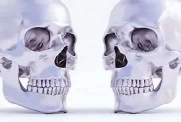 The bruxism construct: From cut‐off points to a continuum spectrum