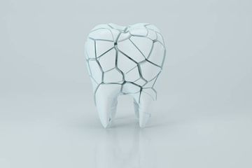 Micro–Computed Tomography Assessment of Dentinal Micro-cracks after Root Canal Preparation with TRUShape and Self-Adjusting File Systems