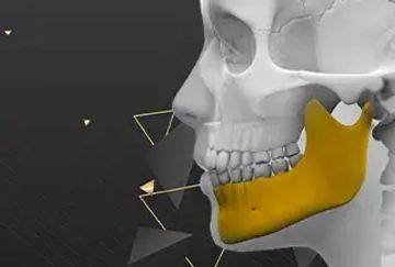 Surface electromyography of jaw muscles and kinesiographic recordings: diagnostic accuracy for myofascial pain 