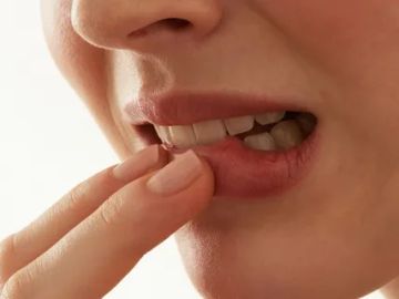Traumatic lesions of the oral mucosa