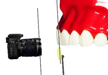 Сложные вопросы внутриротового фотографирования