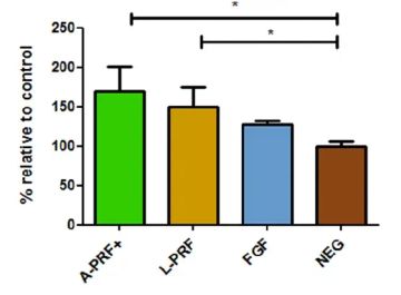 Effects of L-PRF and A-PRF+ on periodontal fibroblasts: an in vitro wound healing assay