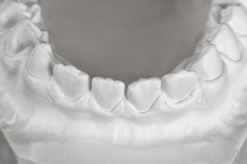 Repeated local delivery of hyaluronic acid gel as adjunctive treatment of residual pockets in periodontitis patients undergoing supportive periodontal care. A randomized controlled clinical trial